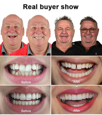 Ultimate Smile Trainer - Instantly Perfect Your Smile